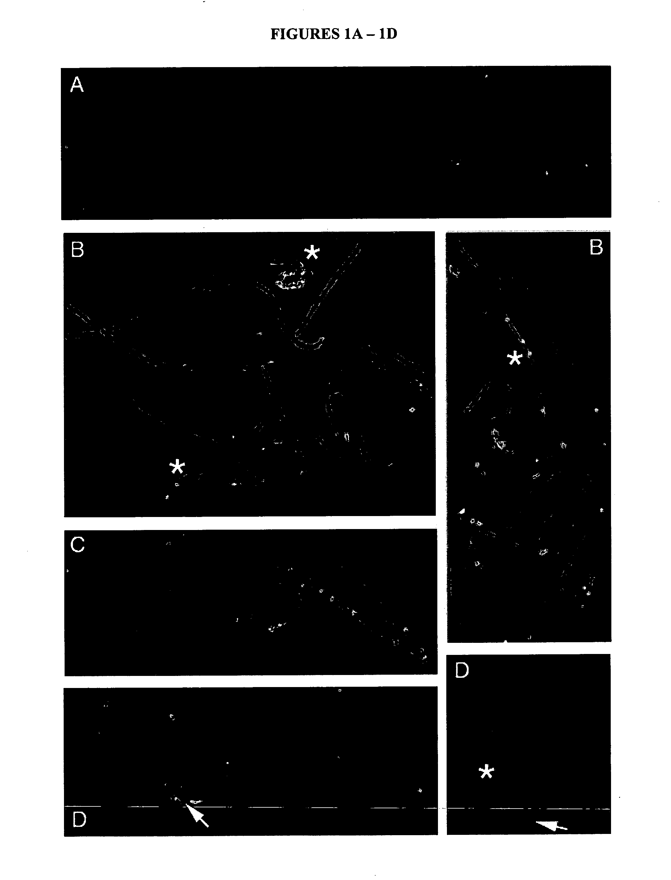 In vitro uptake of SPAM 1 (PH-20) by mammalian sperm