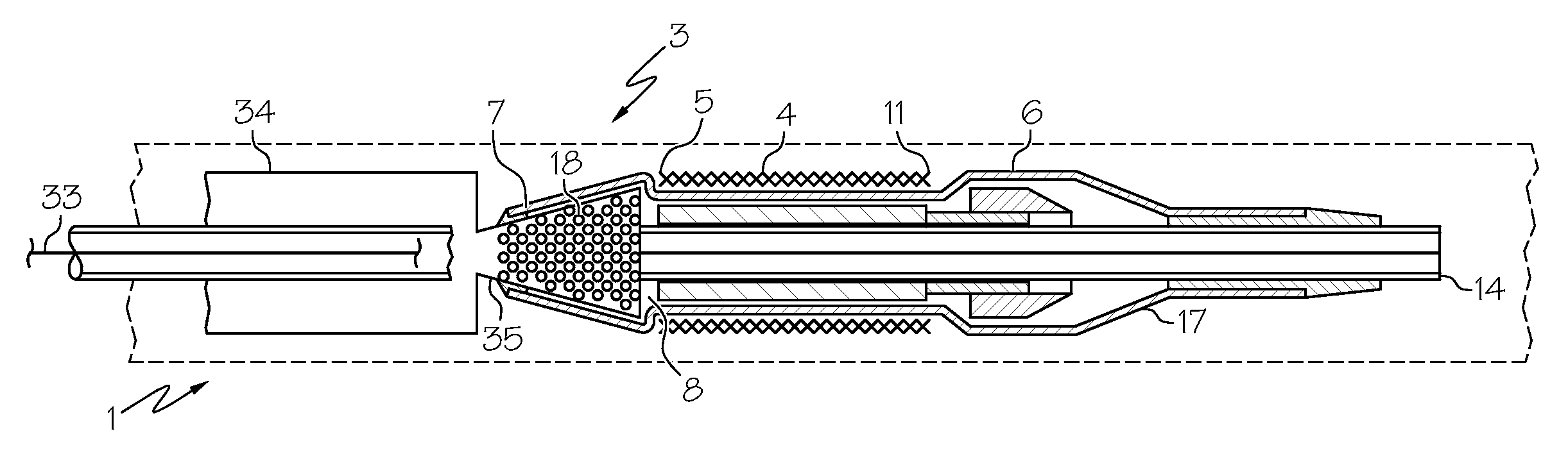 Semi rigid edge protection design for stent delivery system