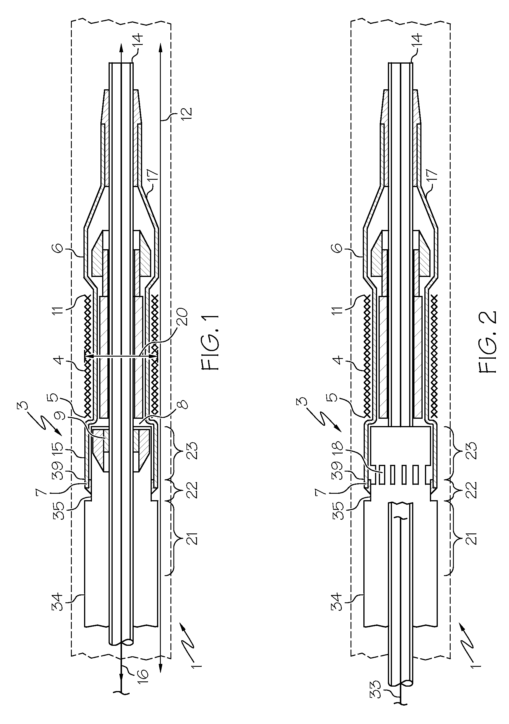 Semi rigid edge protection design for stent delivery system