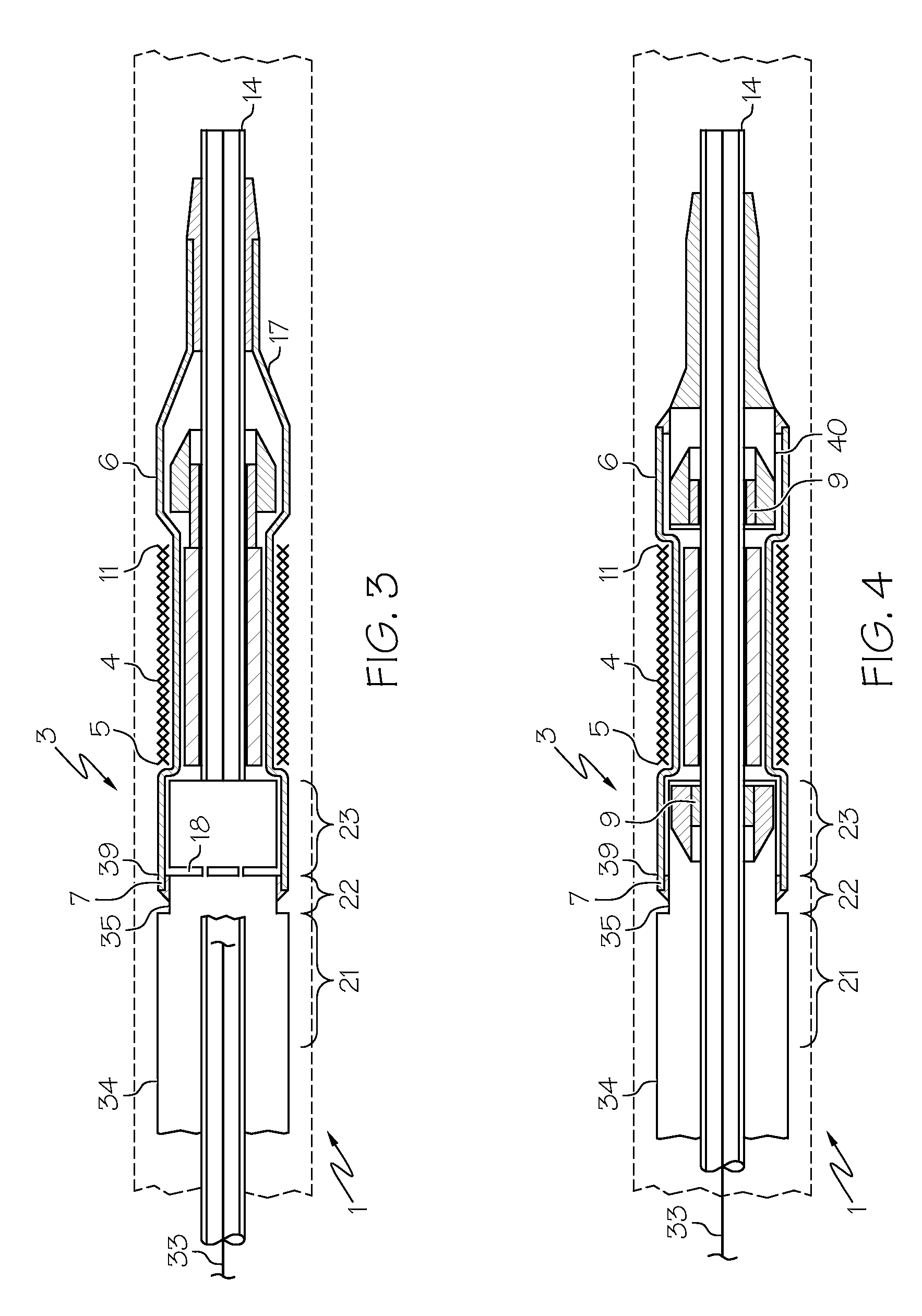 Semi rigid edge protection design for stent delivery system