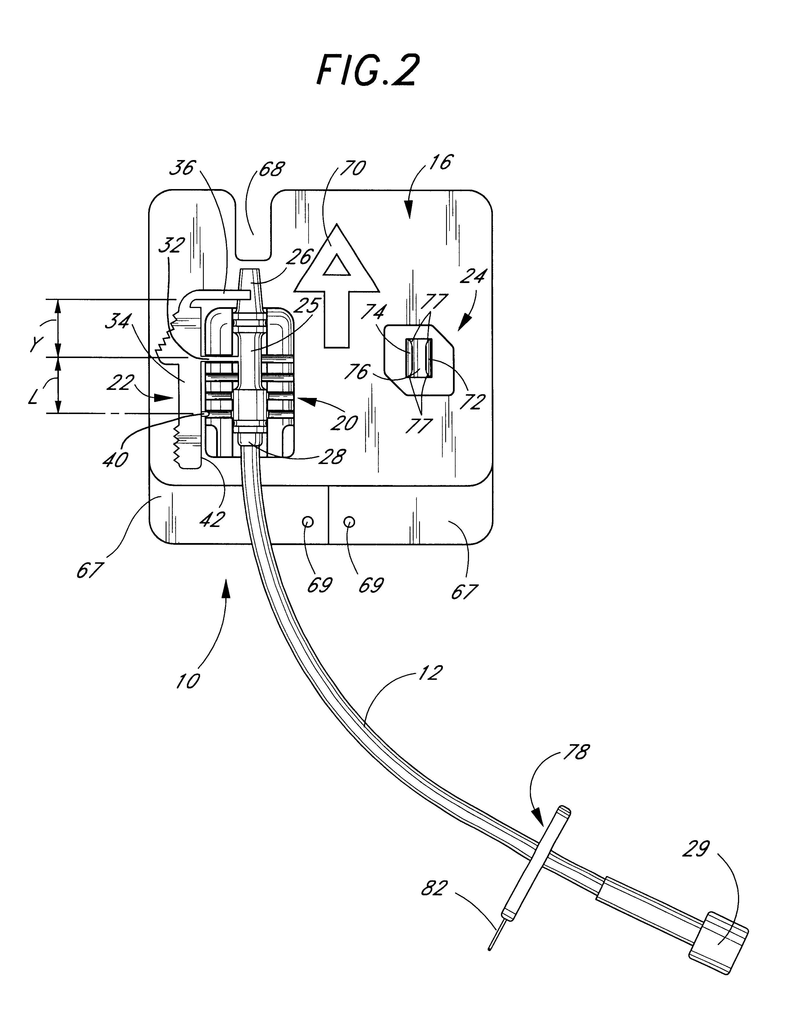 Catheter anchoring system