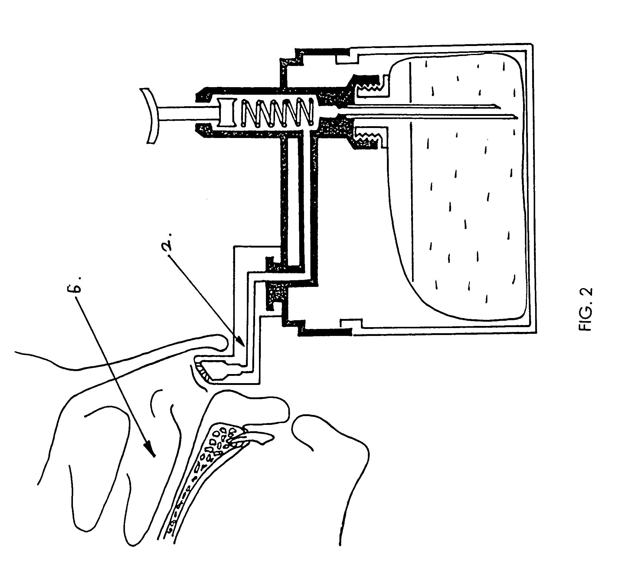 Portable saline nasal spray