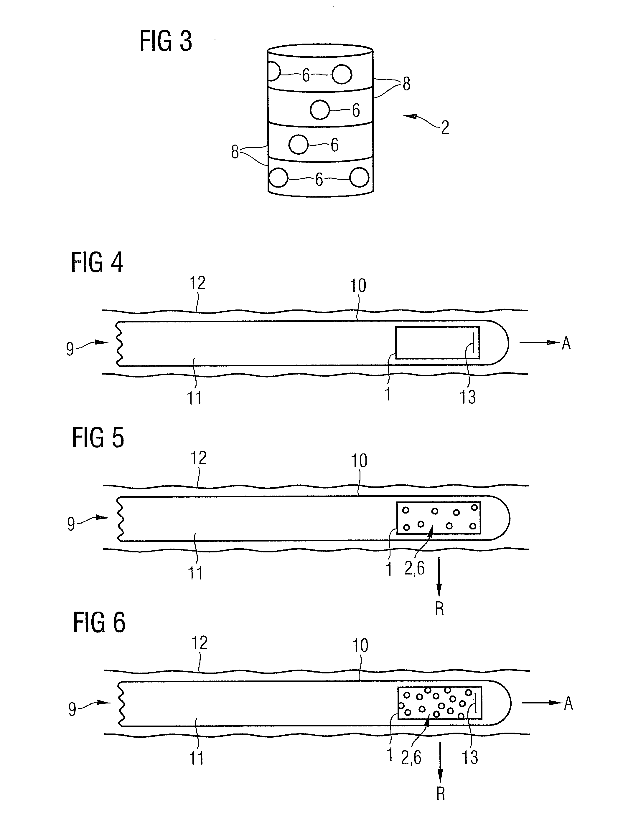 Miniature x-ray tube for a catheter