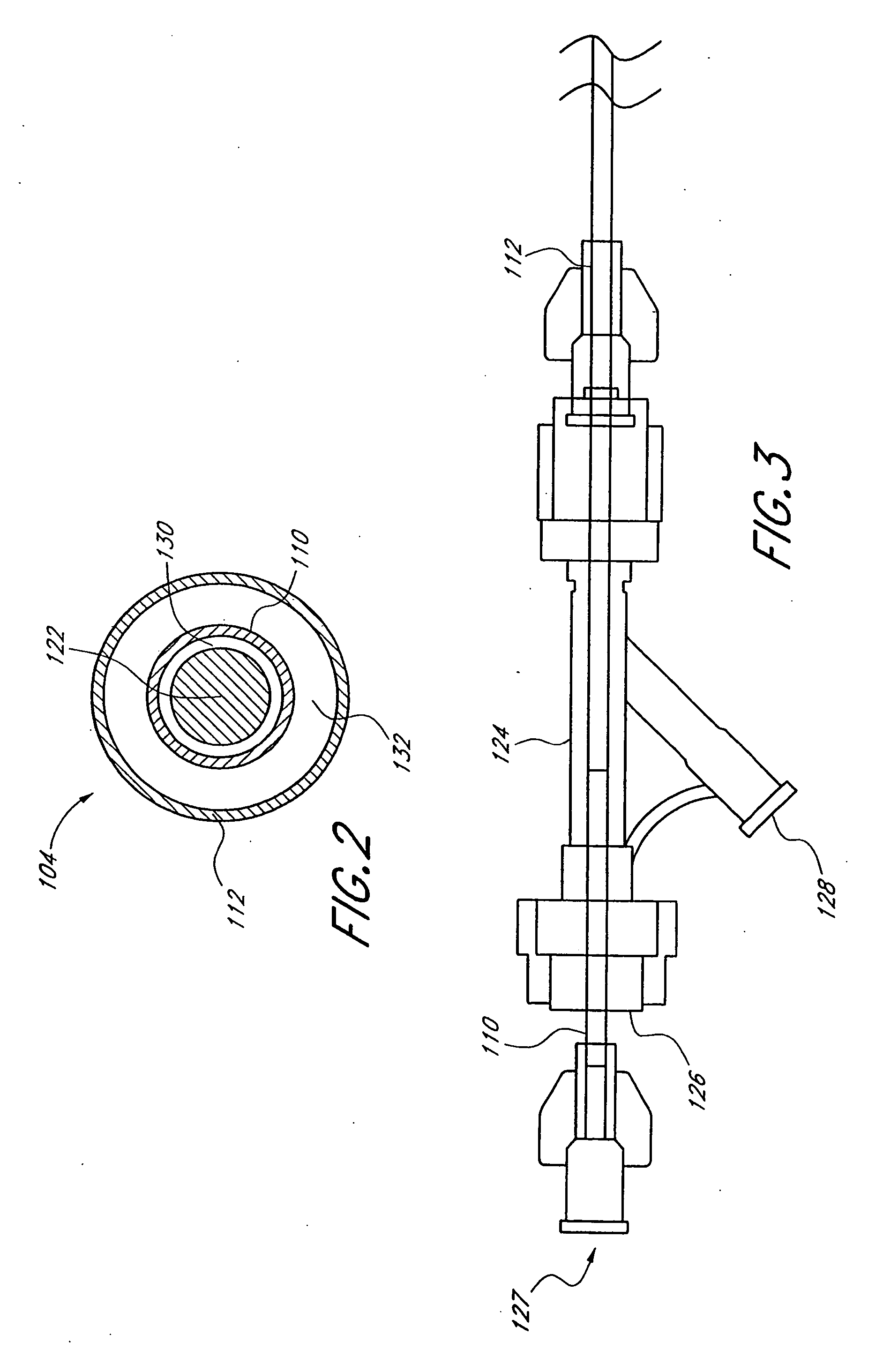 Formed in place fixation system with thermal acceleration