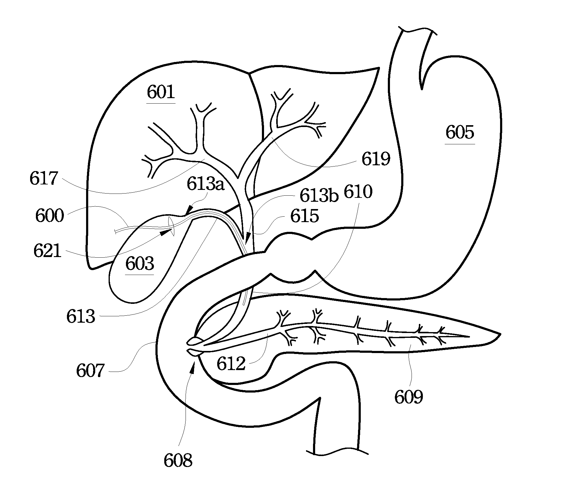 Choledochoilluminating Drainage Device