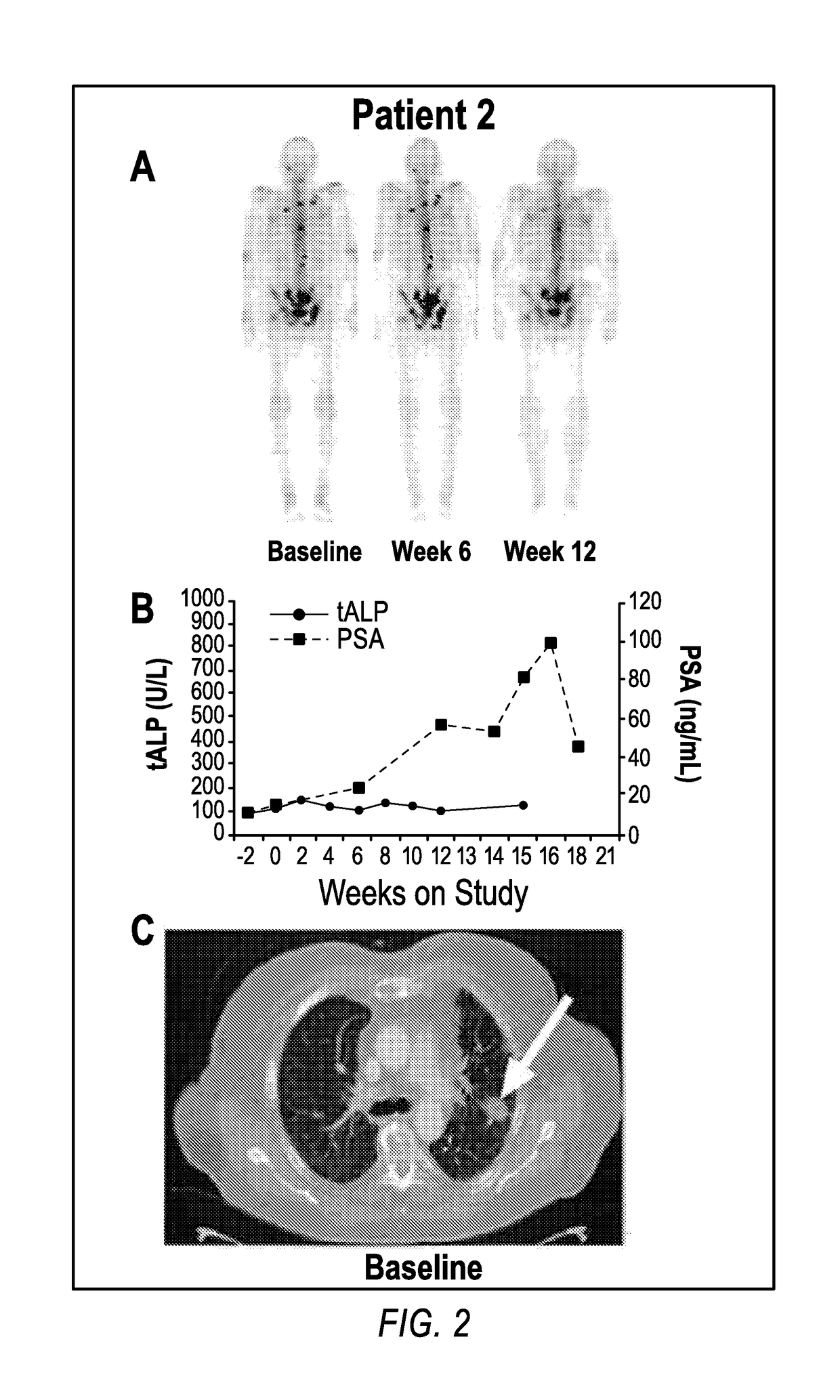 Method of treating cancer