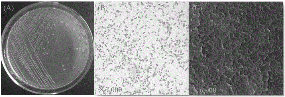 Serratia capable of enriching phosphorus, degrading organic phosphorus and inhibiting plant pathogenic fungi