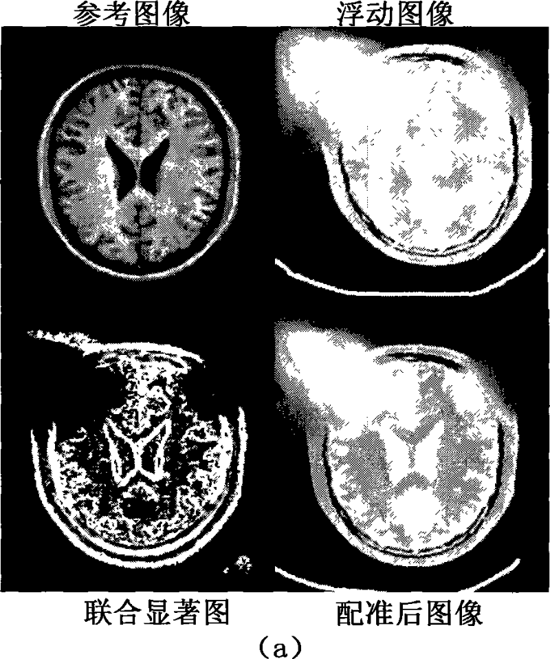 Robust image registration method based on association saliency image in global abnormal signal environment