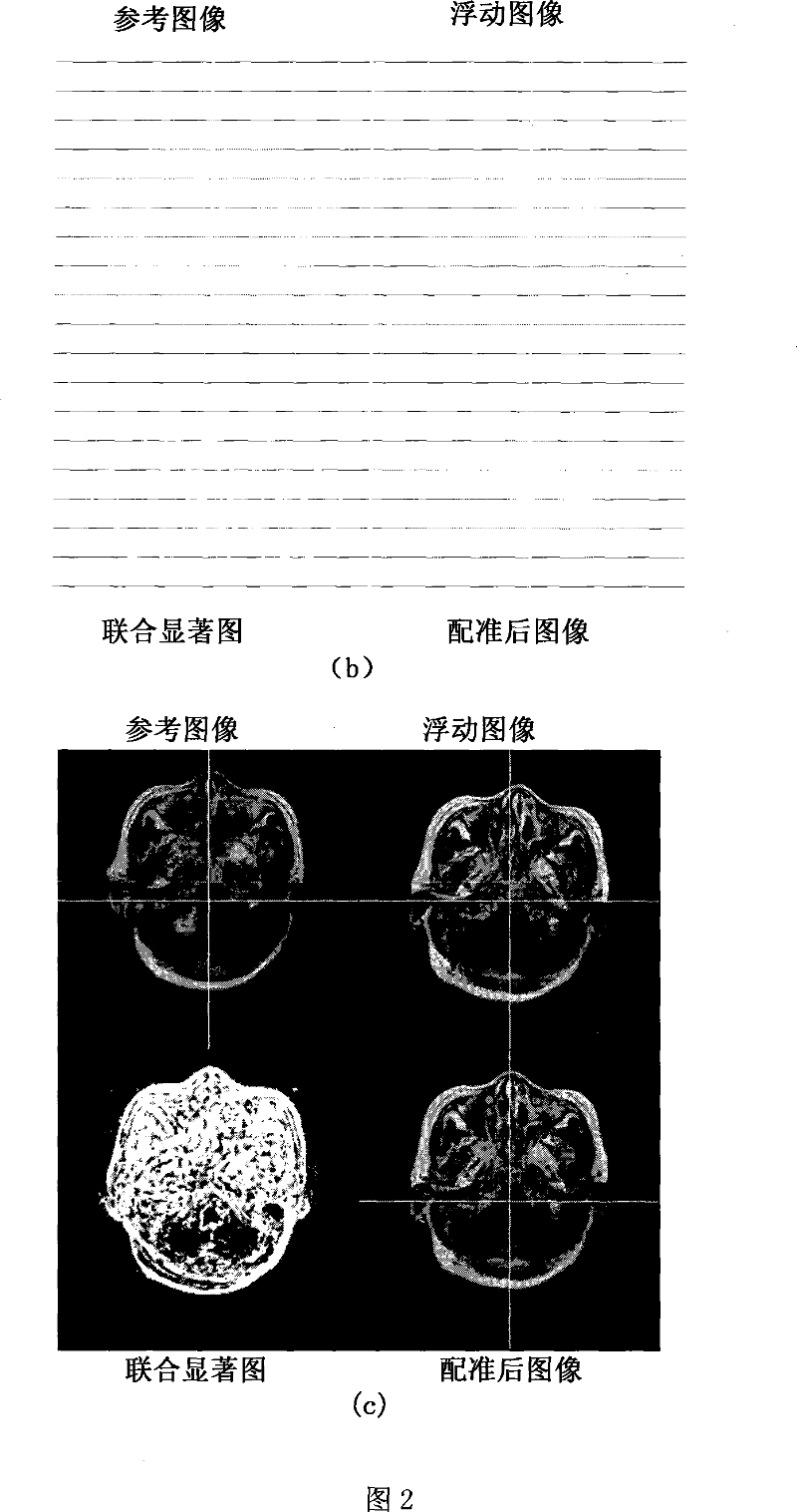 Robust image registration method based on association saliency image in global abnormal signal environment