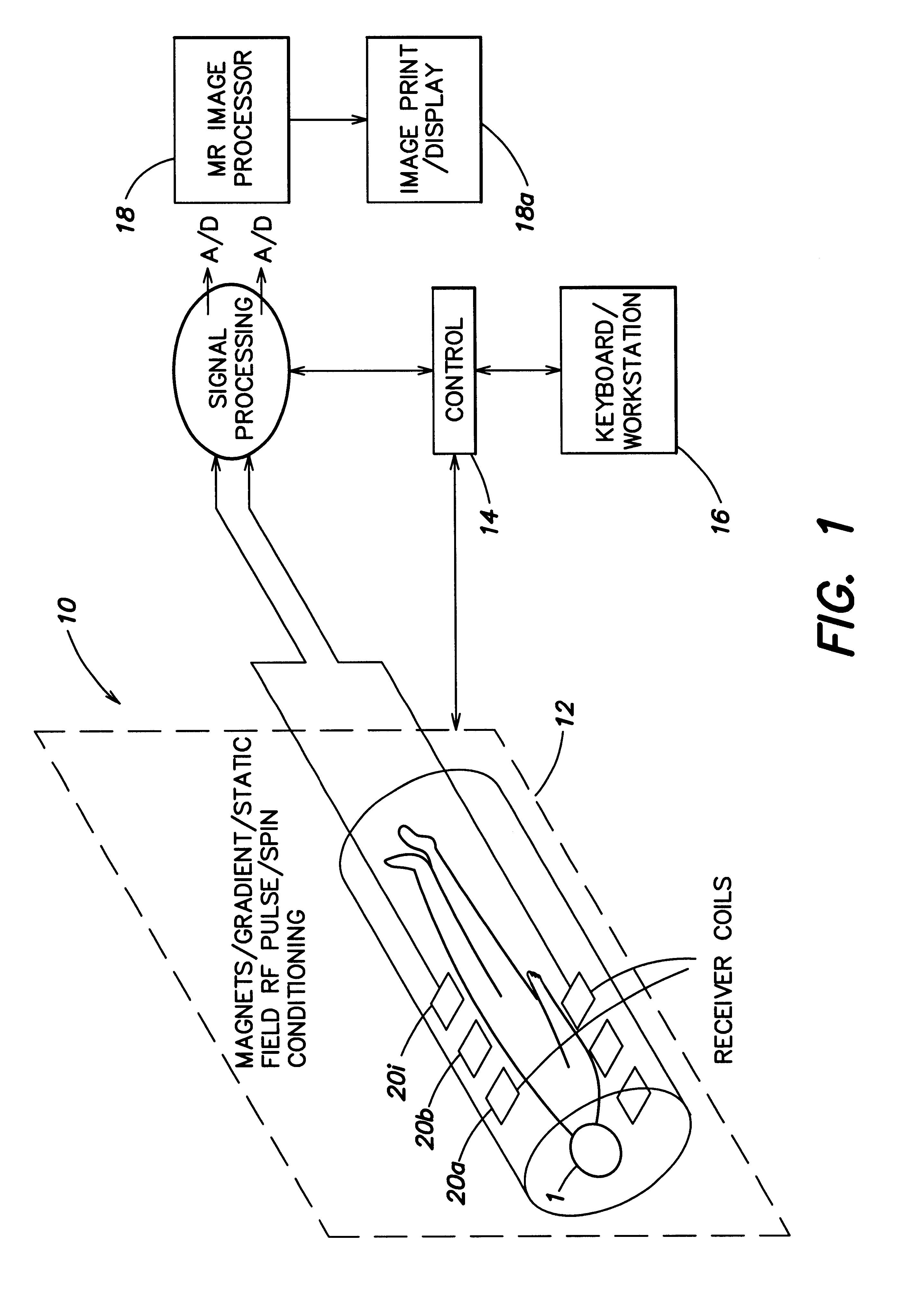 Coil array autocalibration MR imaging