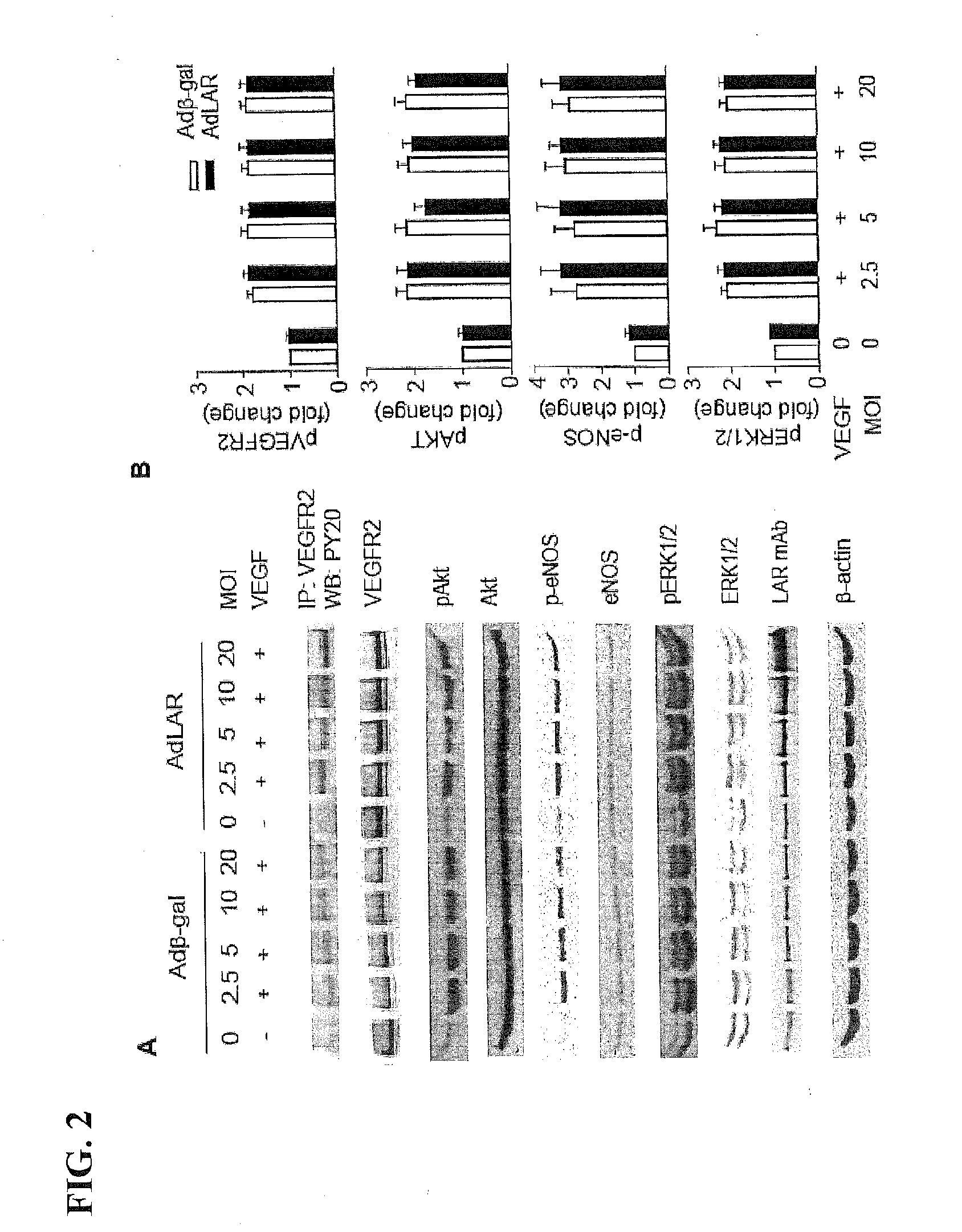 Inhibition of LAR Phosphatase to Enhance Therapeutic Angiogenesis