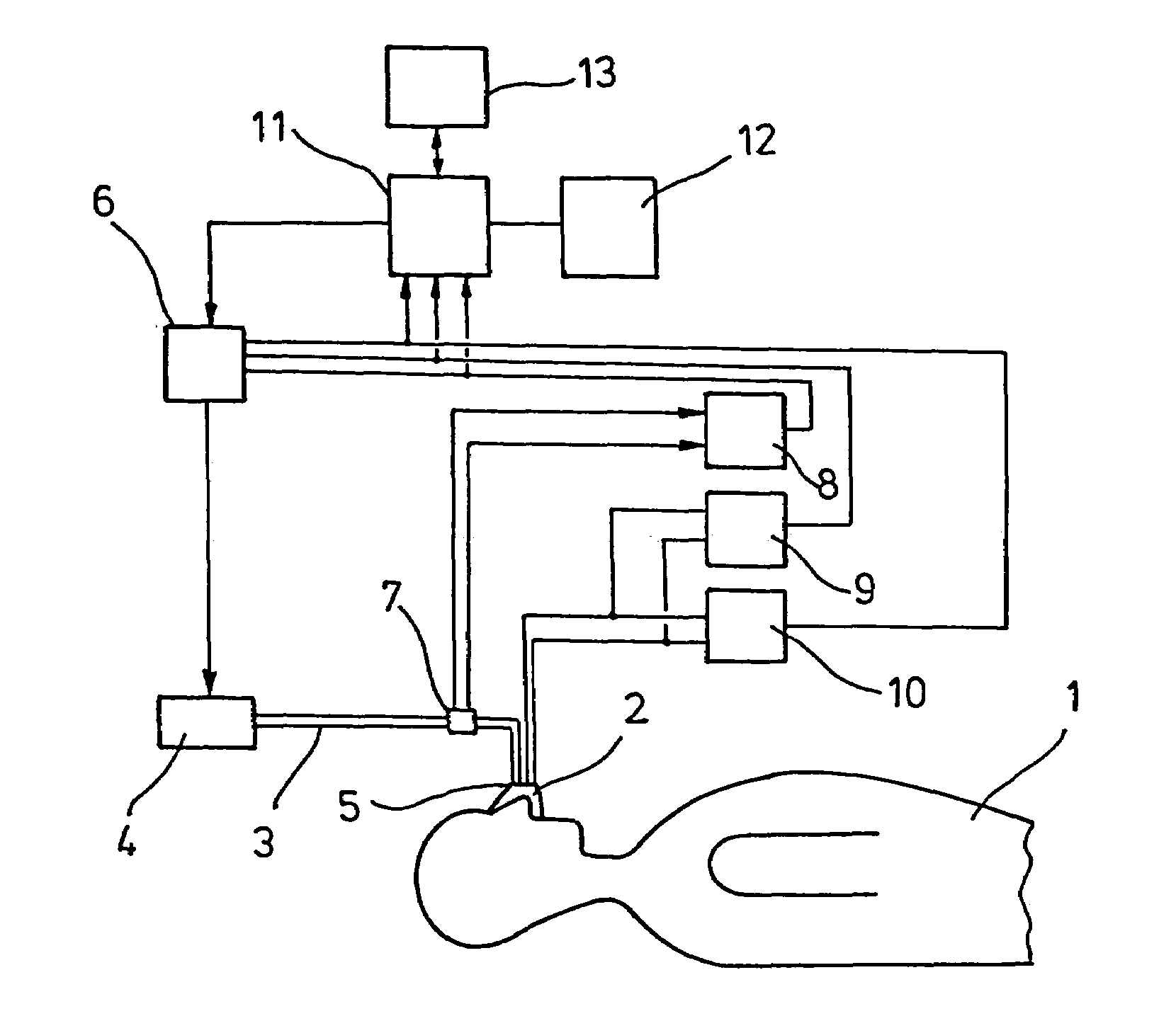 Procedure for the control of a respirator device as well as apparatus for monitoring