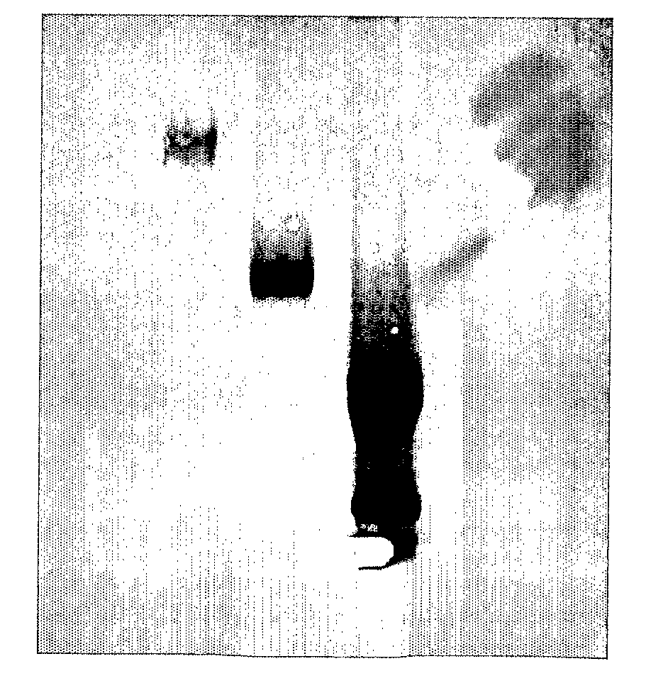 Recombinant Polypeptides and Methods for Detecting and/or Quantifying Autoantibodies Against Tsh Receptor