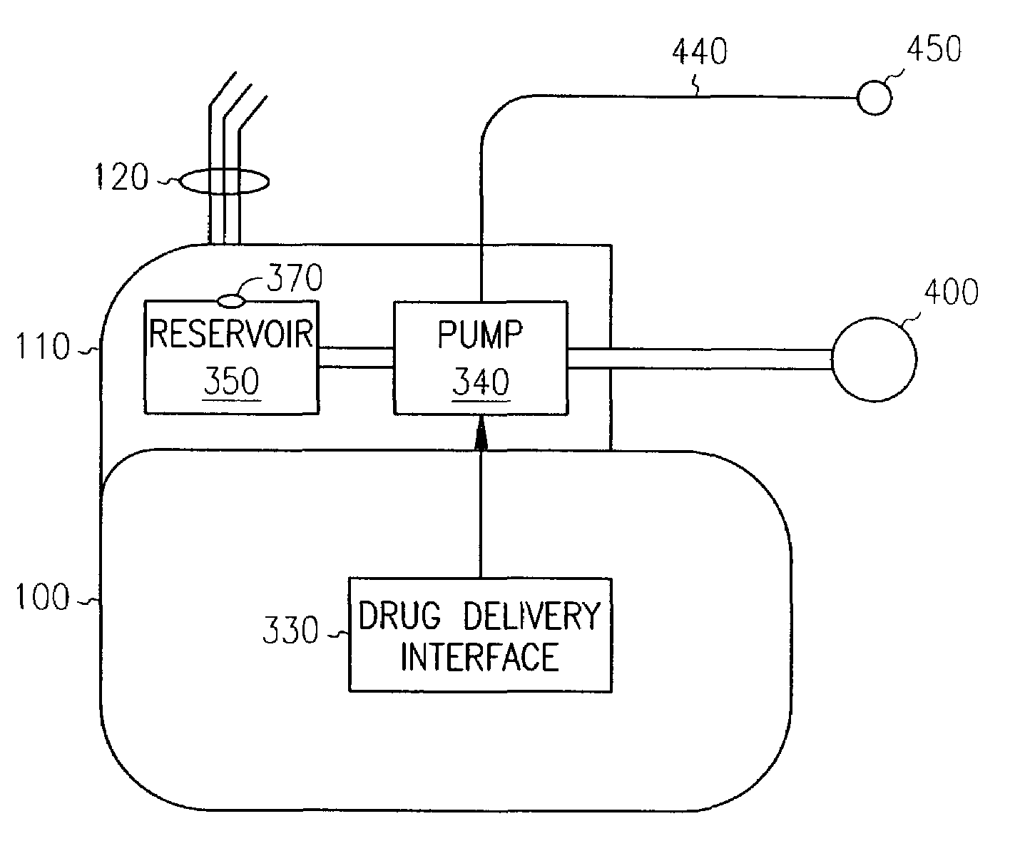 Implantable device for delivering cardiac drug therapy