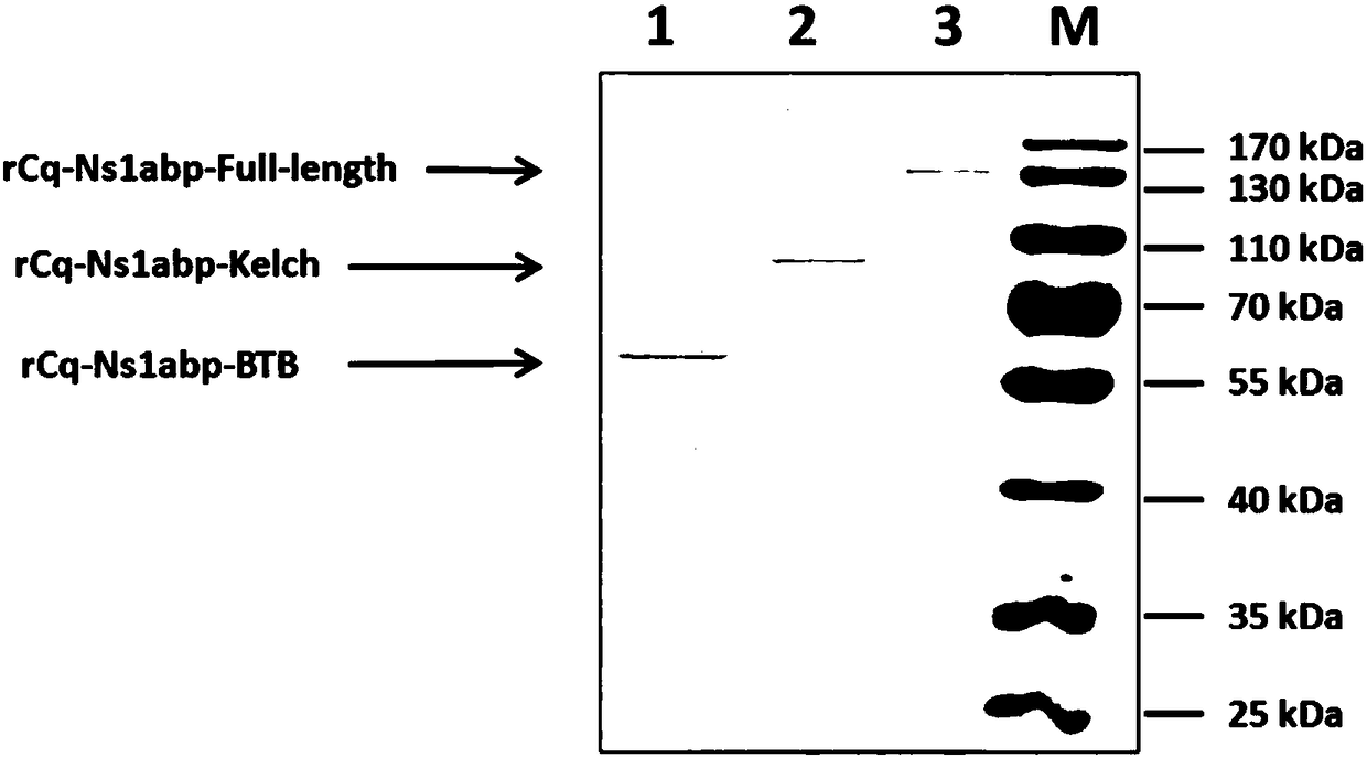 Cq-Ns1abp gene for inhibiting WSSV infection and application of protein thereof in resistance of virus activity