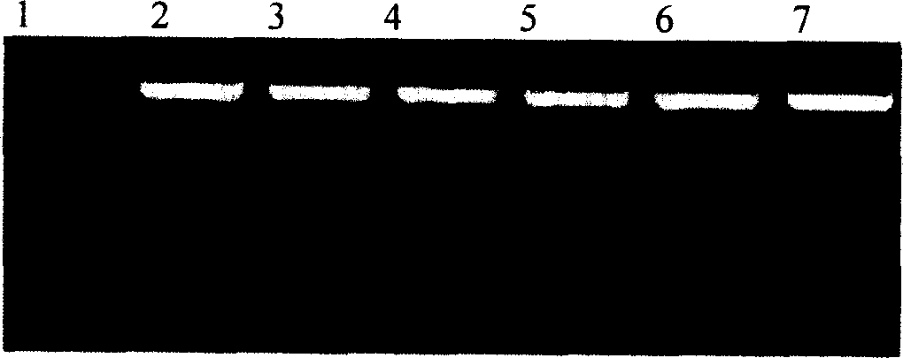 Immune tbid gene and its coded protein and application