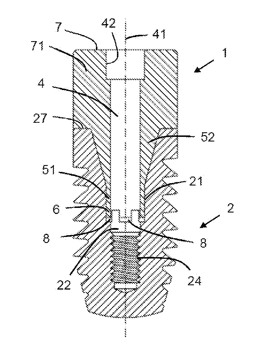 Dental abutment, abutment and screw assembly, and dental implant system