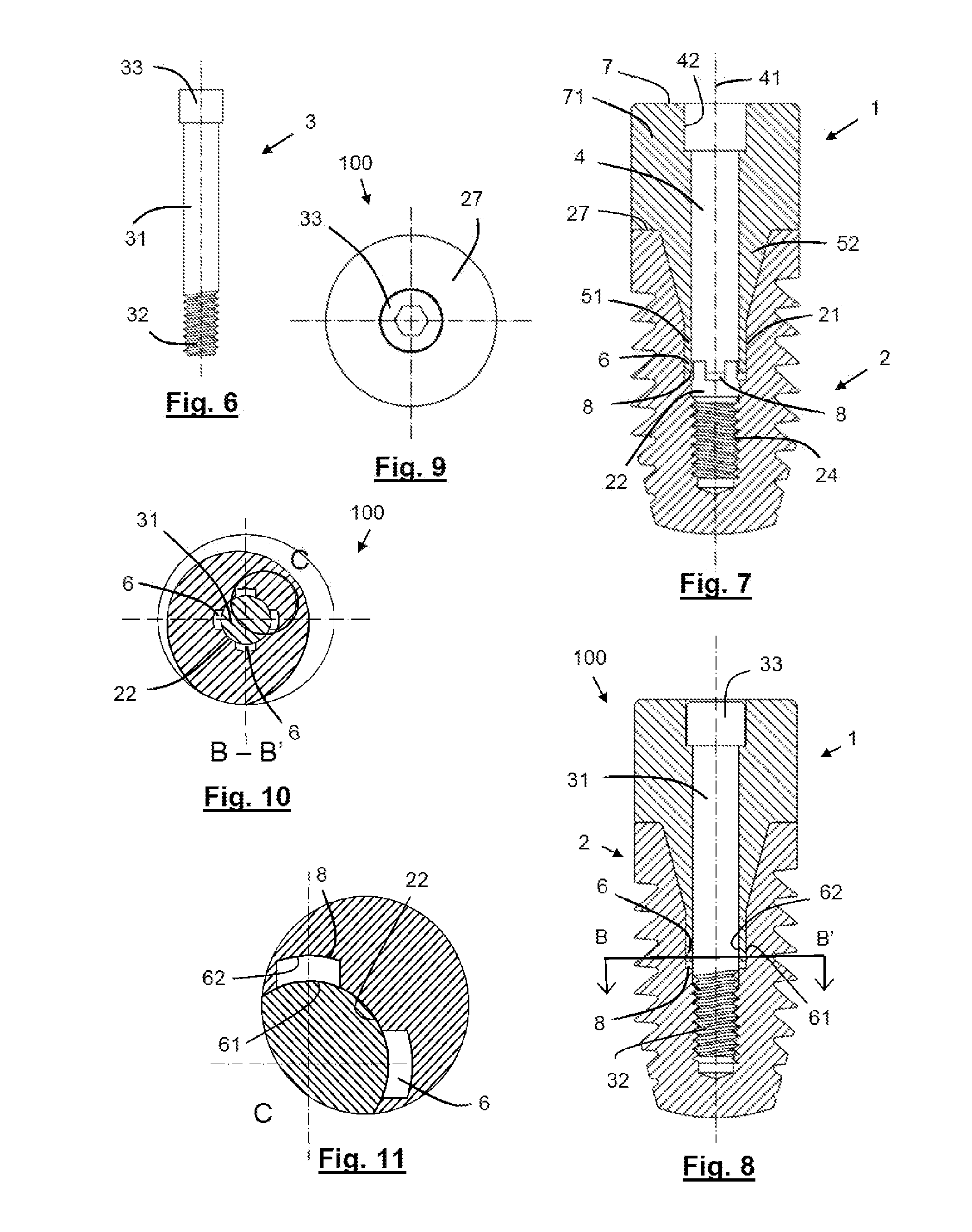 Dental abutment, abutment and screw assembly, and dental implant system