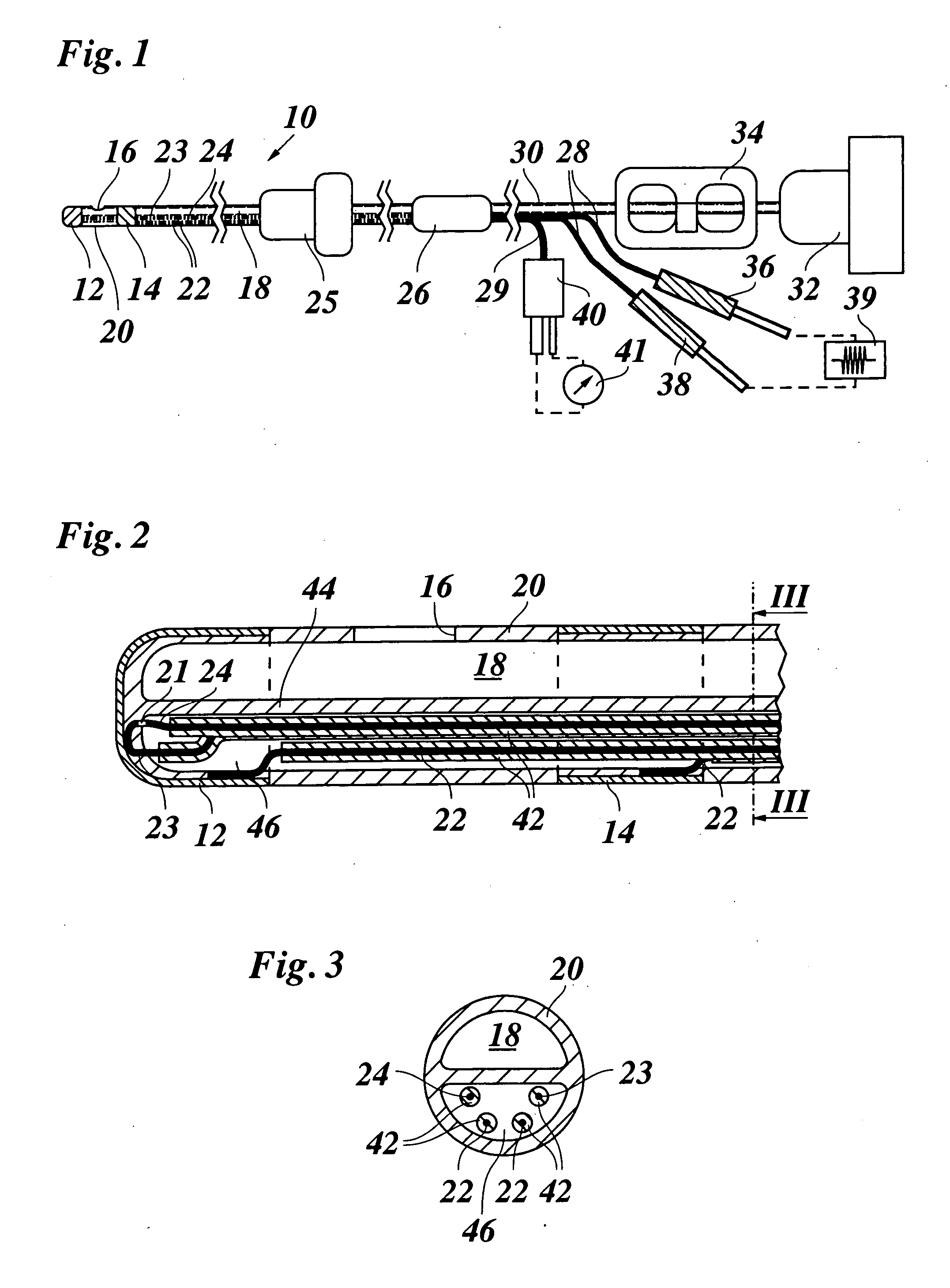 Catheter