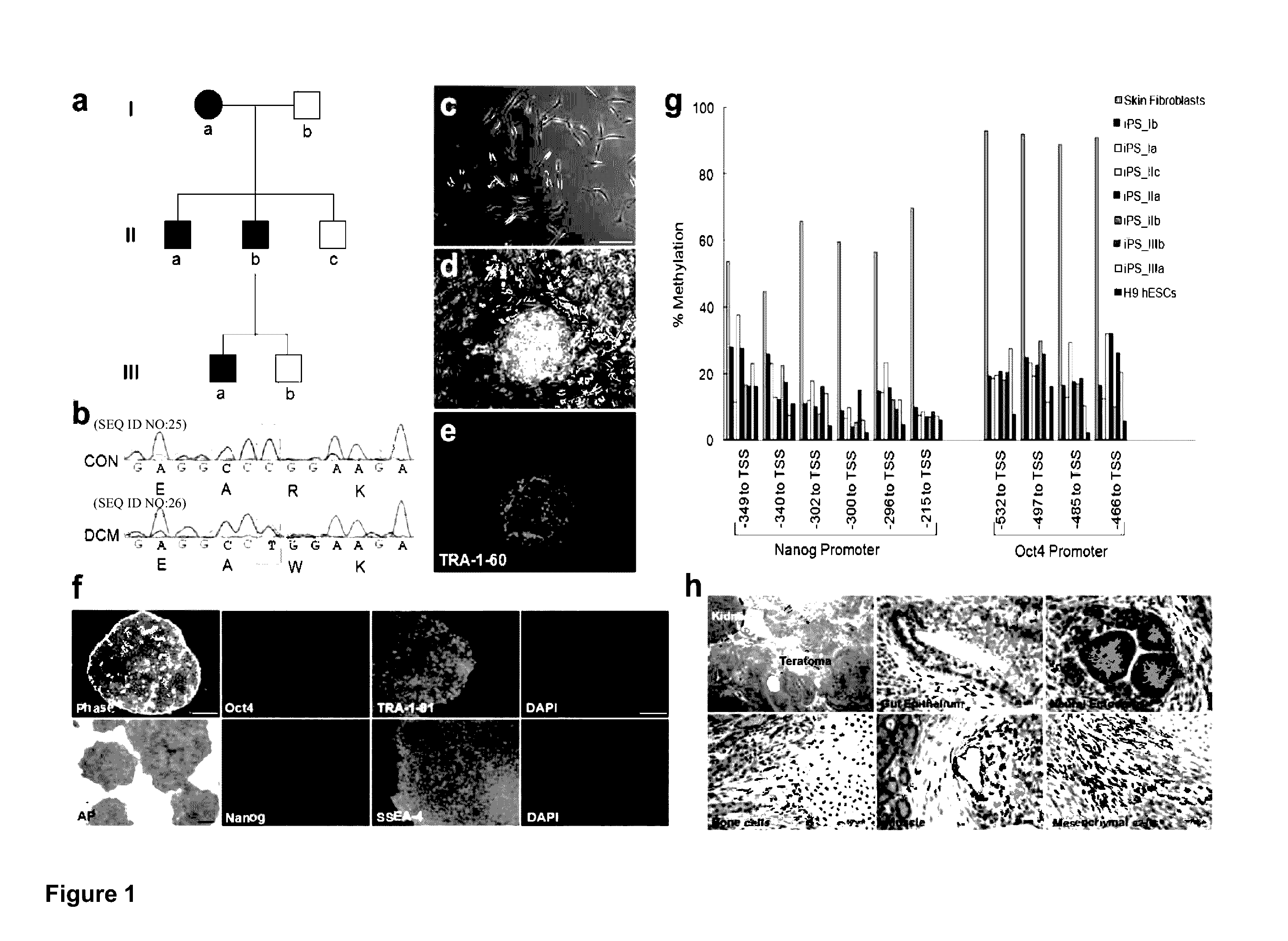 Cardiomyocytes From Induced Pluripotent Stem Cells From Patients and Methods of Use Thereof