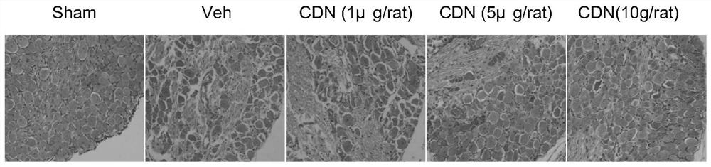 Application of CDN1163 in preparation of medicine for relieving or treating neuropathic pain