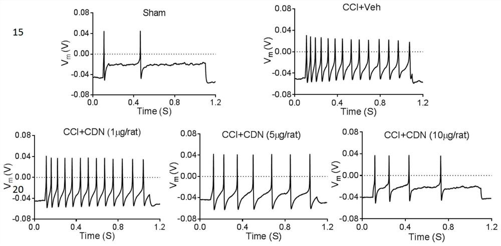 Application of CDN1163 in preparation of medicine for relieving or treating neuropathic pain