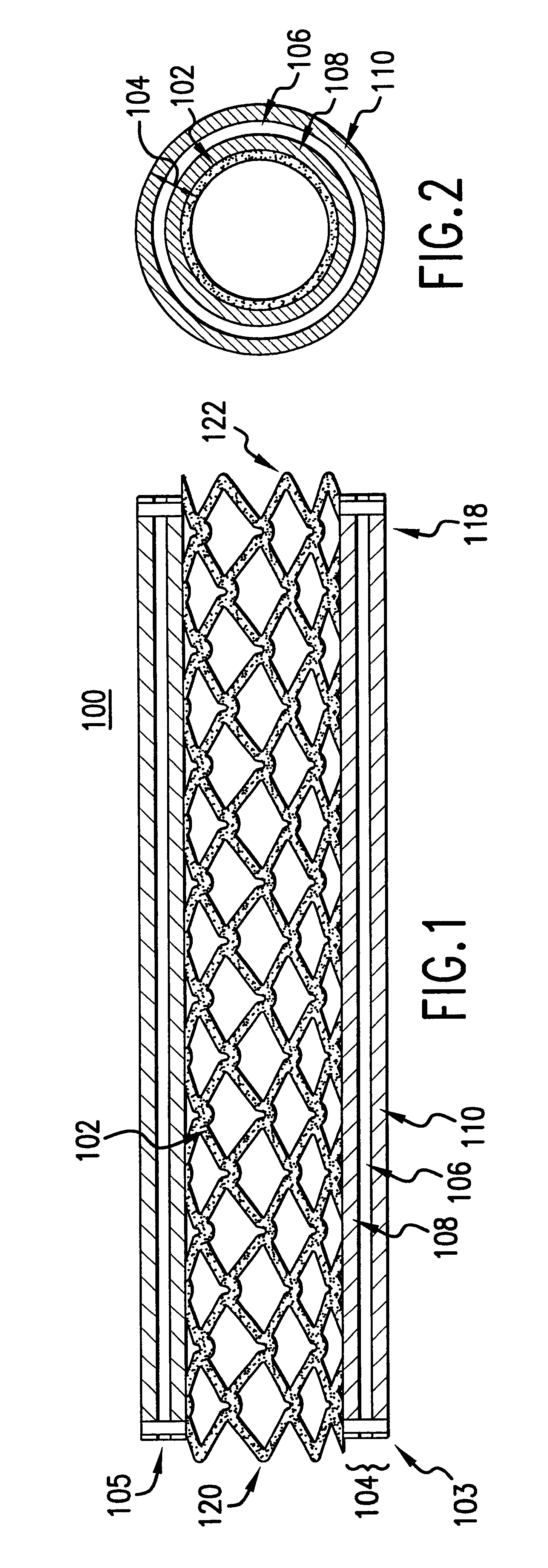 Stent having cover with drug delivery capability