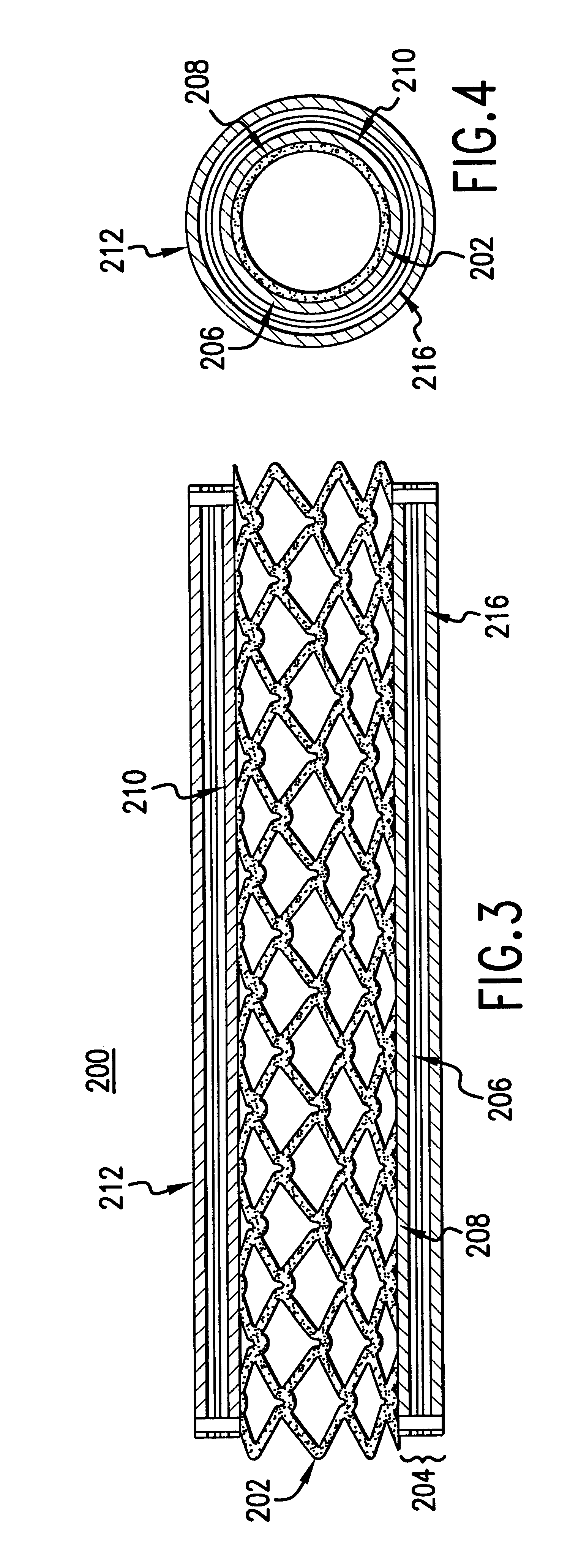 Stent having cover with drug delivery capability