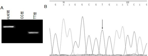 A kit for rapid detection of il28b SNP rs12979860 polymorphism