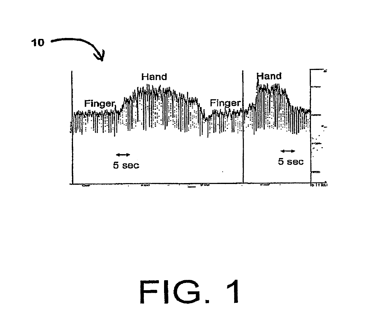 Body Lumen Junction Localization