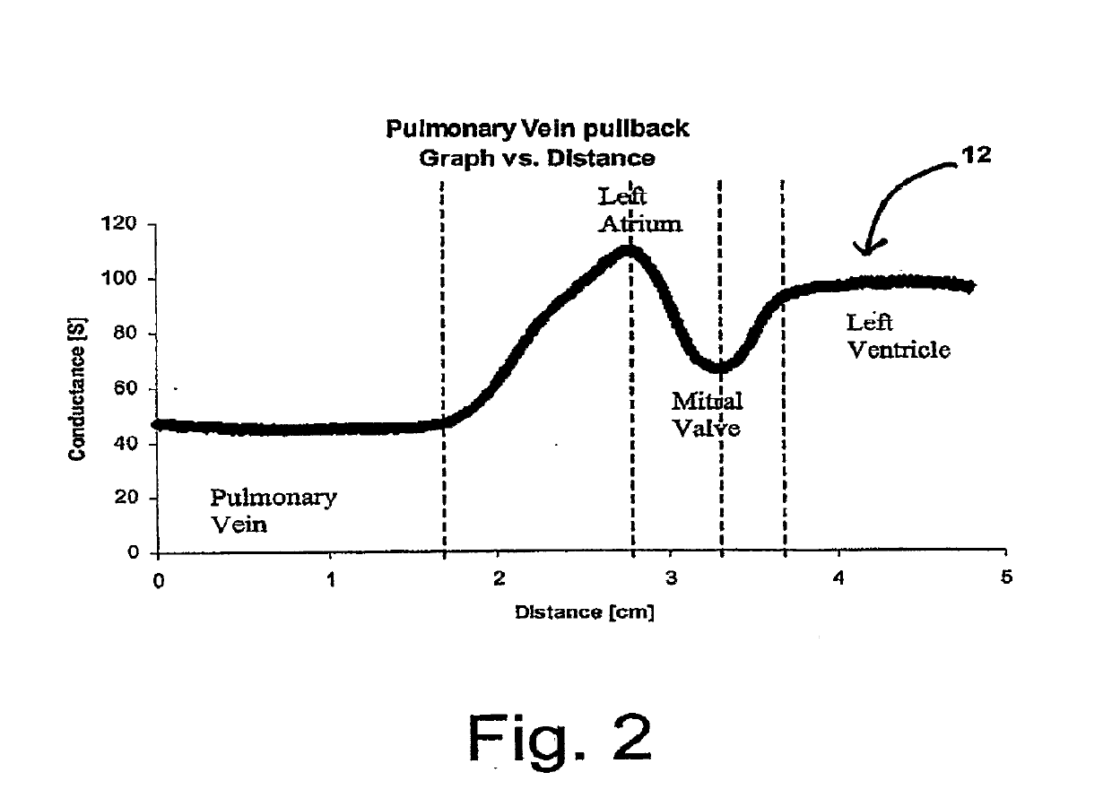 Body Lumen Junction Localization