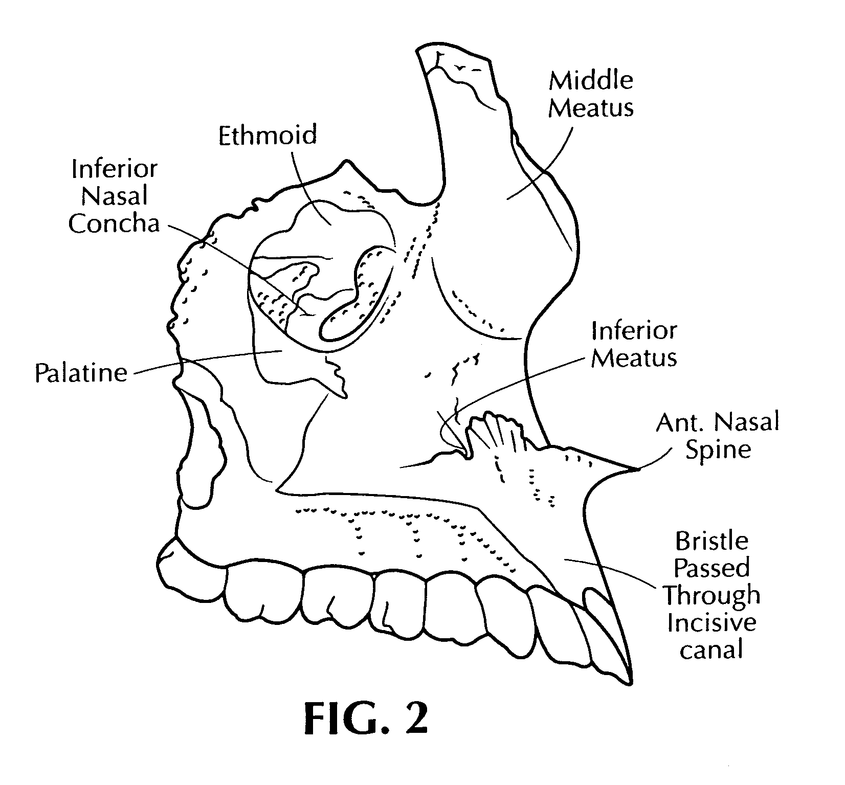 Training aid for a dental injection