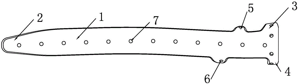 Periprosthetic femoral fracture revision locking steel plate