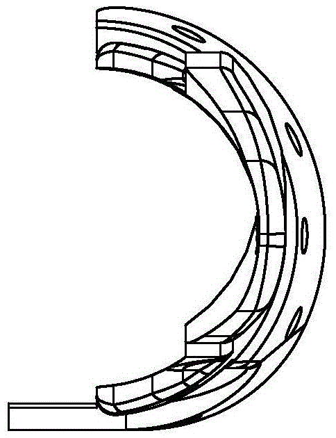 Periprosthetic femoral fracture revision locking steel plate