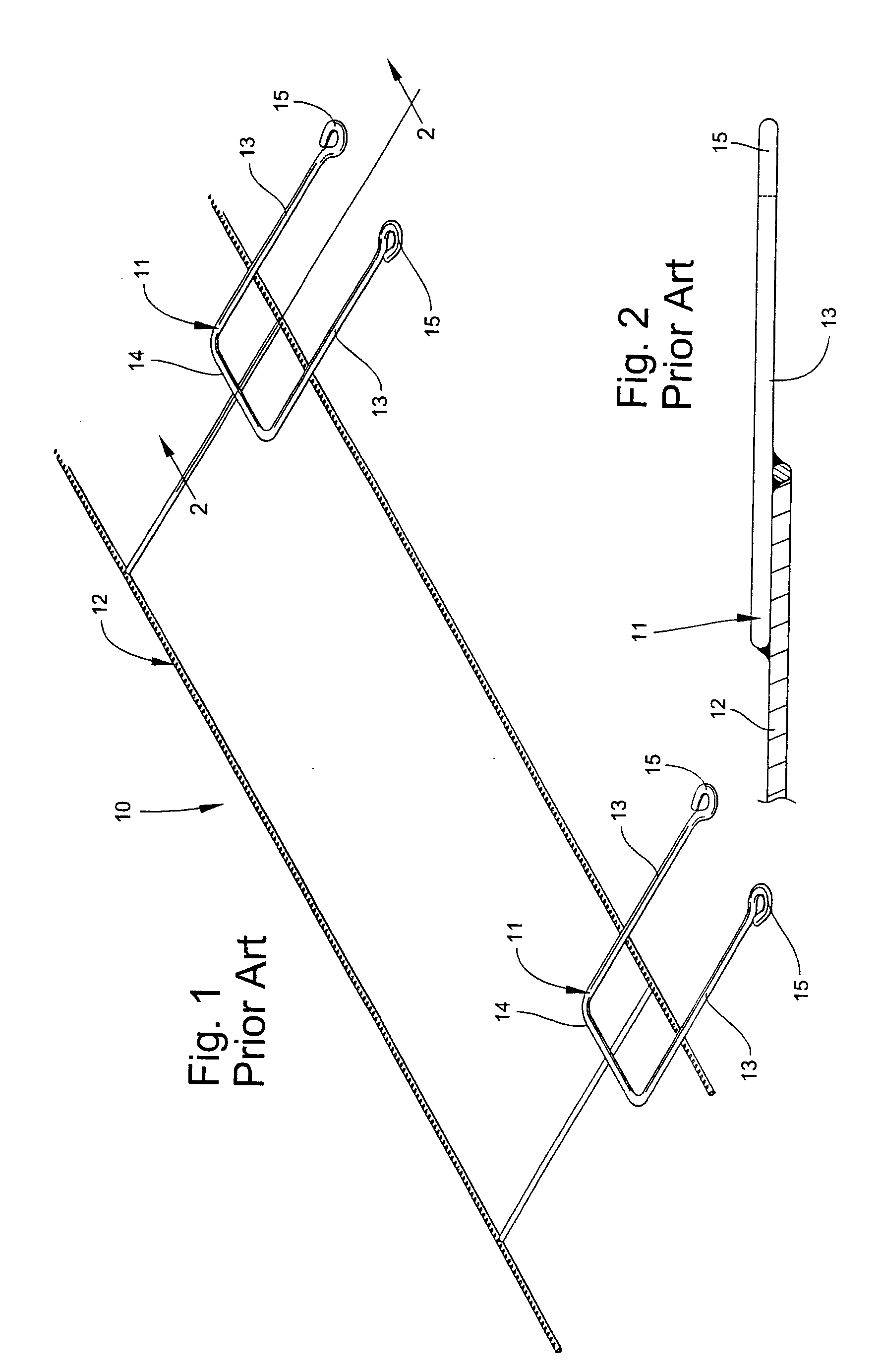 Masonry anchoring system