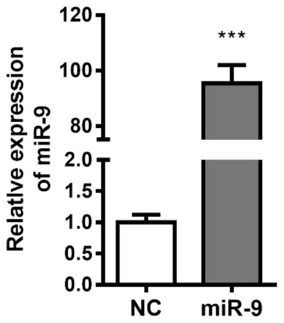 Characterization of mir-9 overexpressing tumors and their treatment and specific markers