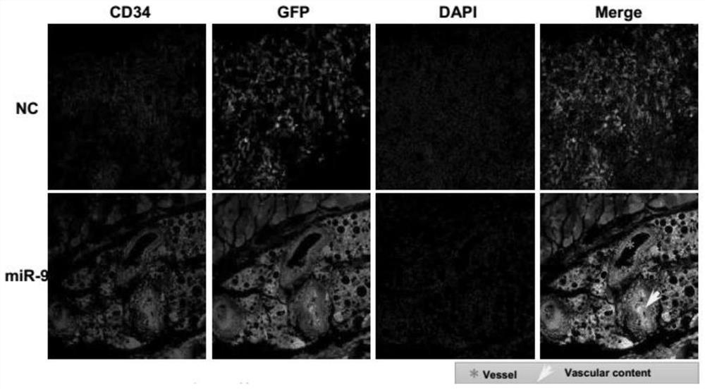 Characterization of mir-9 overexpressing tumors and their treatment and specific markers