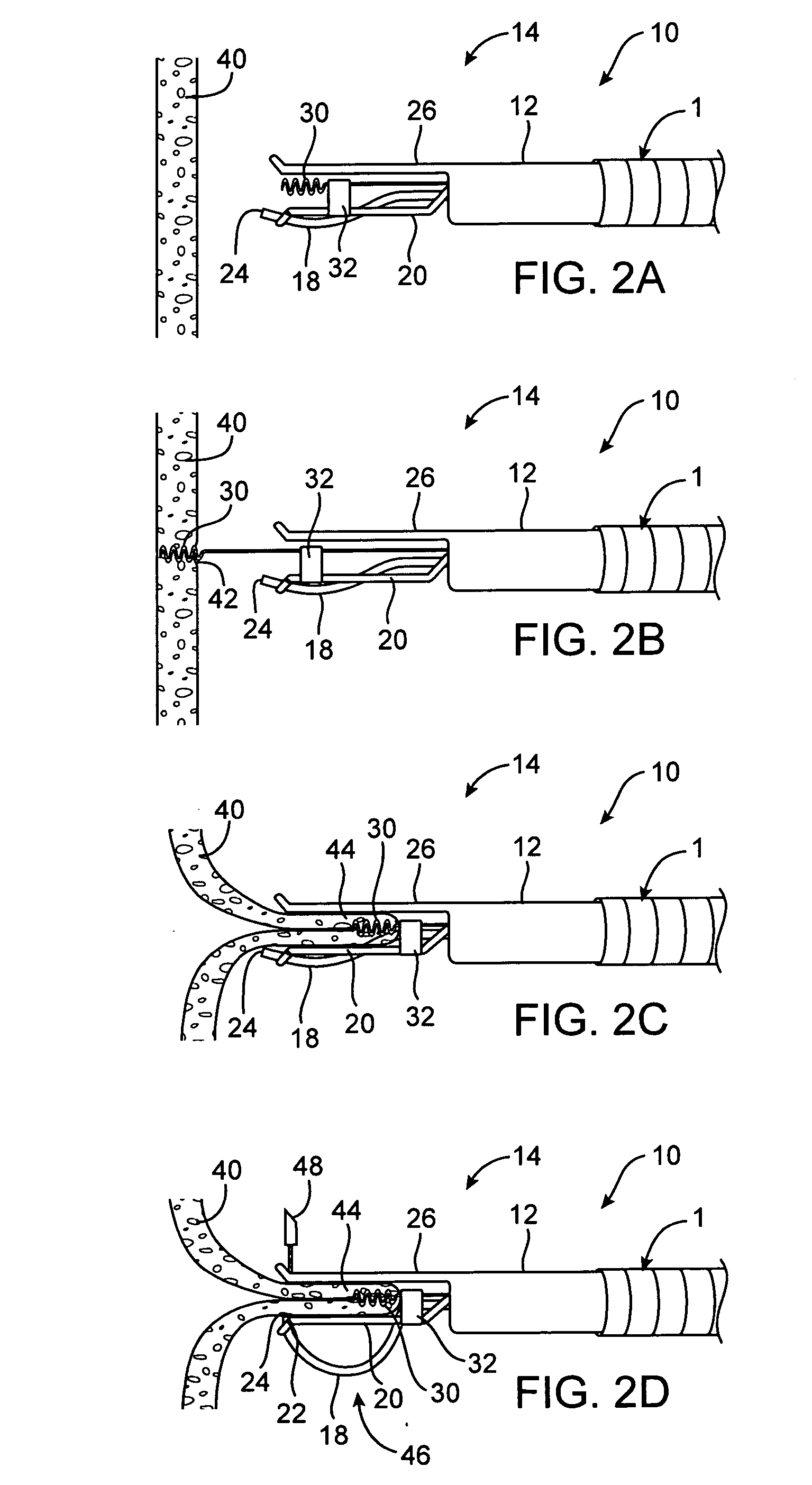 Apparatus and methods for achieving prolonged maintenance of gastrointestinal tissue folds