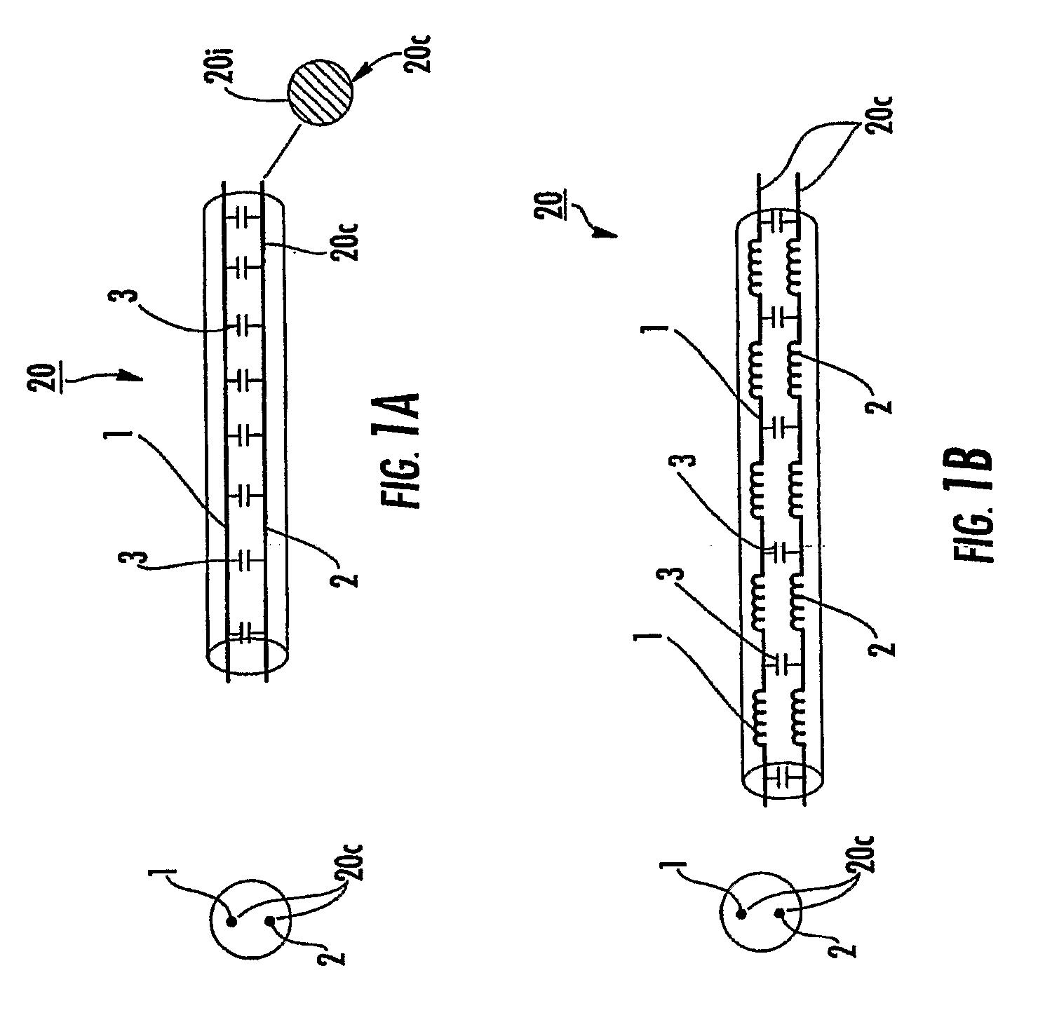 Mri-safe high impedance lead systems