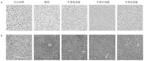 Application of great burdock root polysaccharide in preparation of drug for treating non-alcoholic fatty liver disease