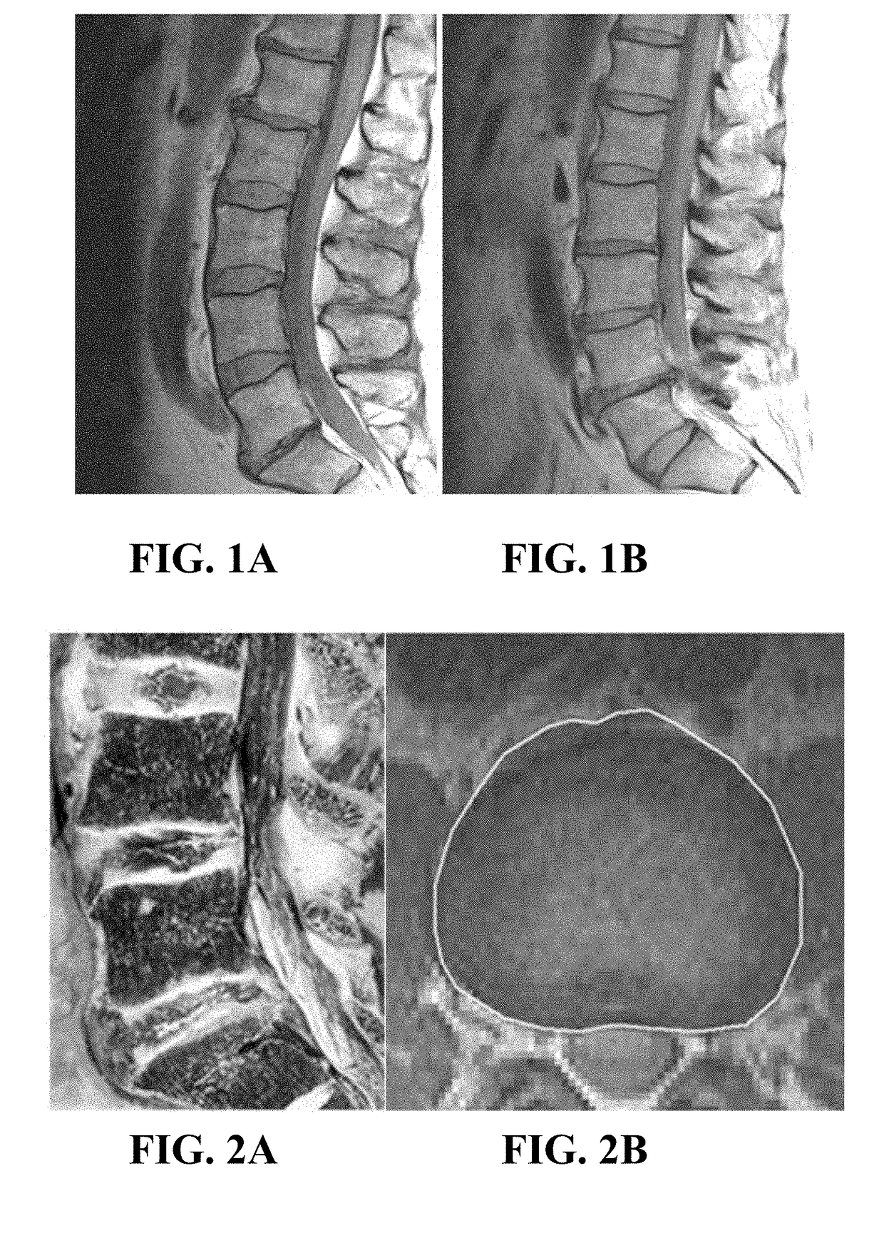 Systems and methods for identification and prediction of structural spine pain