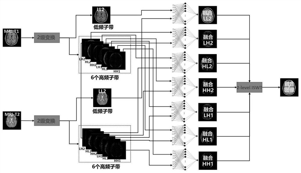 Multi-modal medical image fusion method