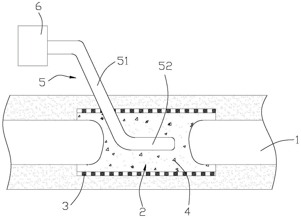 Bone Graft Device for Repairing Large Bone Defects