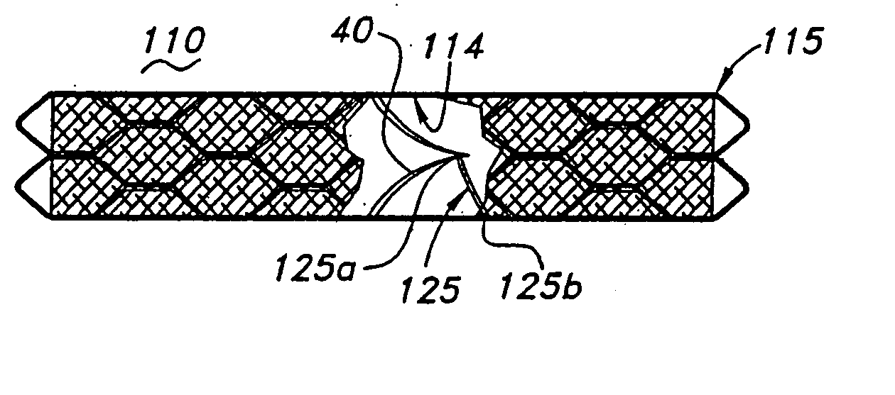 Implantable prosthetic valve