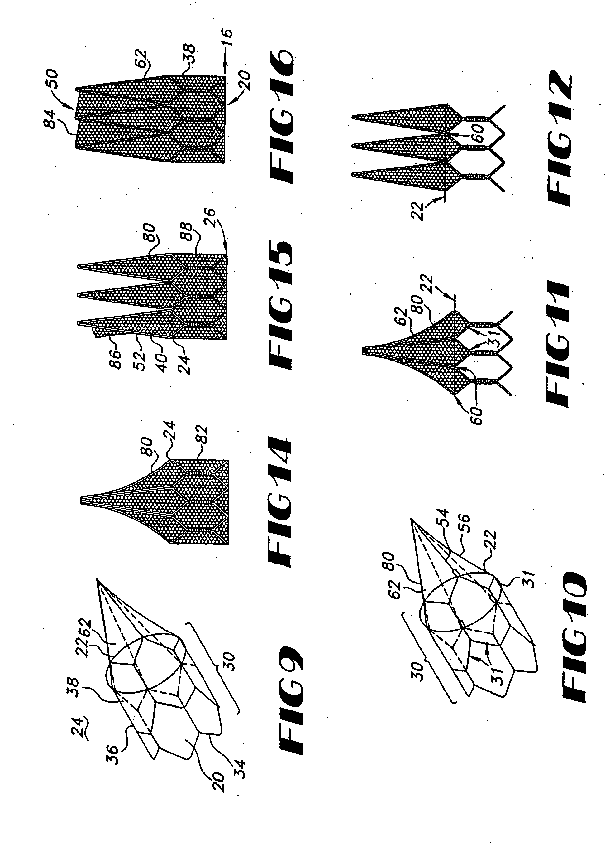 Implantable prosthetic valve