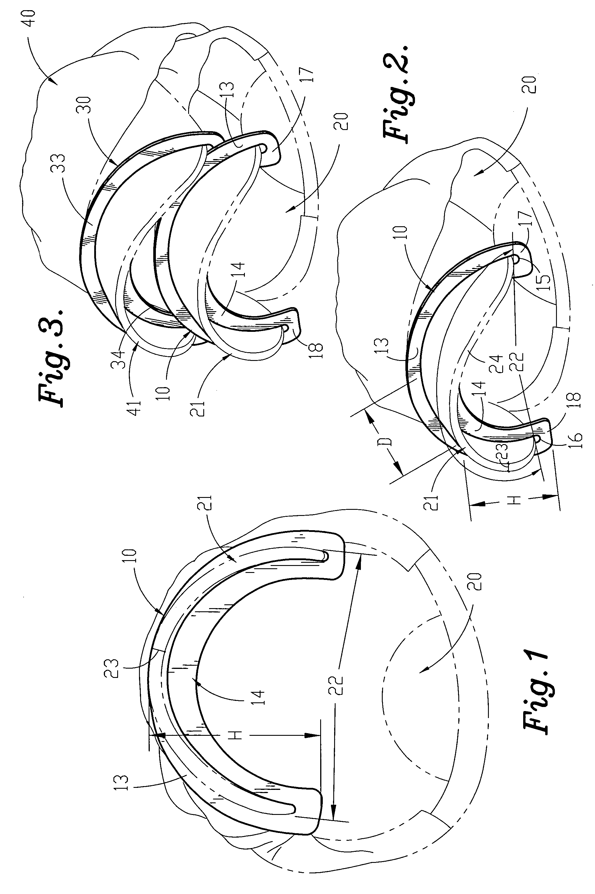 Athletic headwear shaping device and method