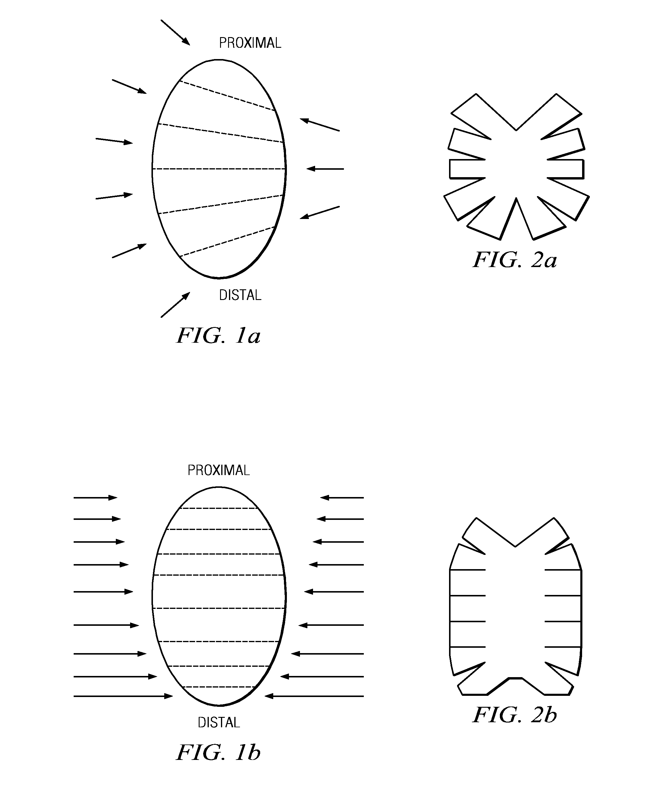 Customizable therapeutic compression garment and method