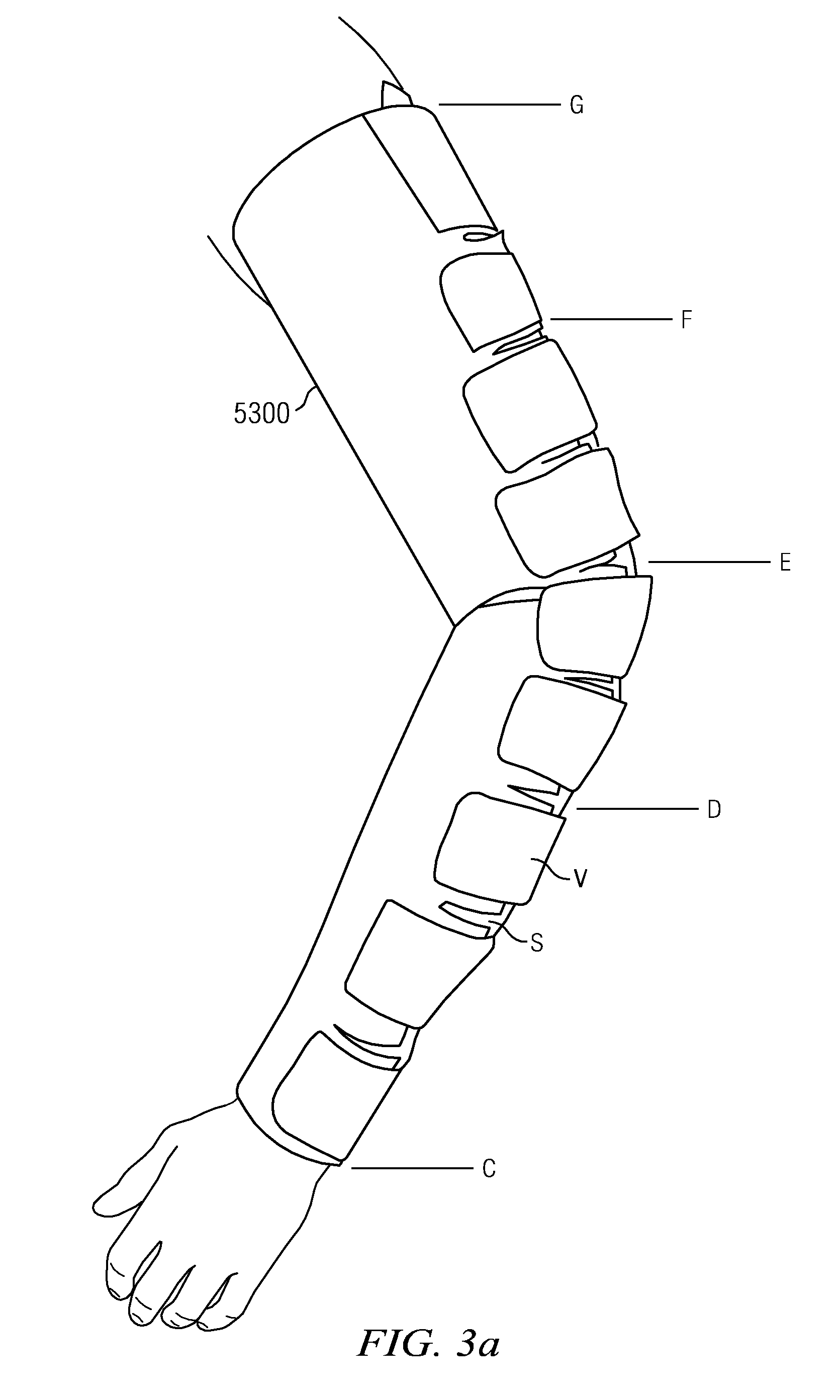 Customizable therapeutic compression garment and method