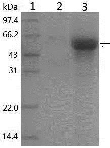 Porcine circovirus bivalent genetic engineering vaccine