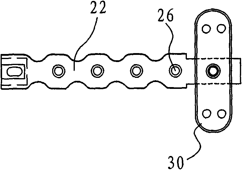 Artificial chest rib